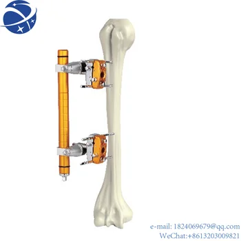 Ортопедичен алвеолата-хонорар на раменната кост Юн YI.